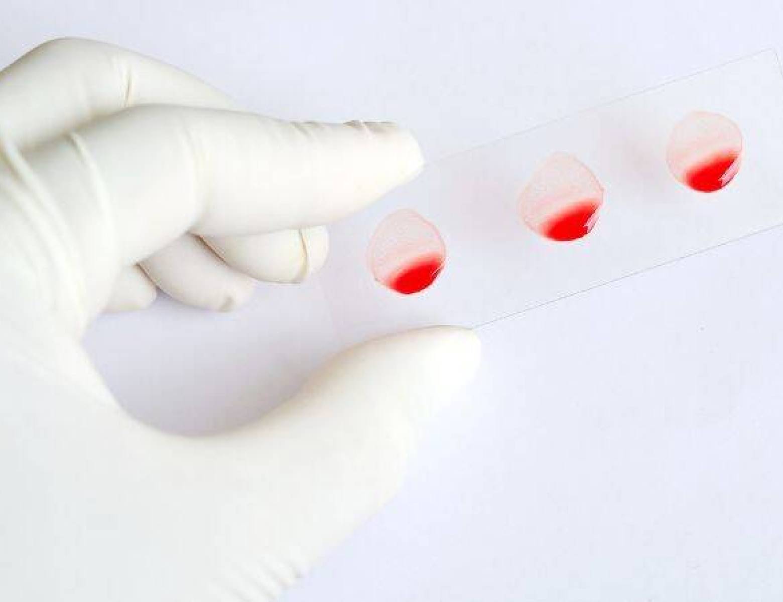 Cechy poszczególnych grup krwi i ich wpływ na zdrowie człowieka